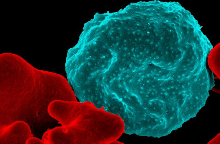Malaria-infected red blood cell. 