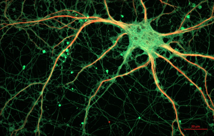 Neuron.
