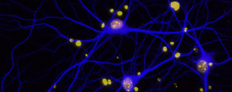 Image of synapses.