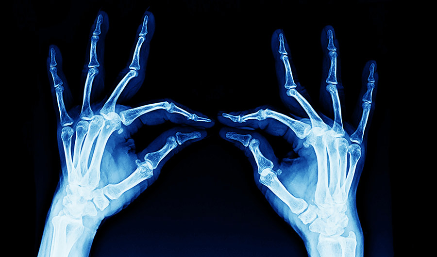 X-ray of two hands