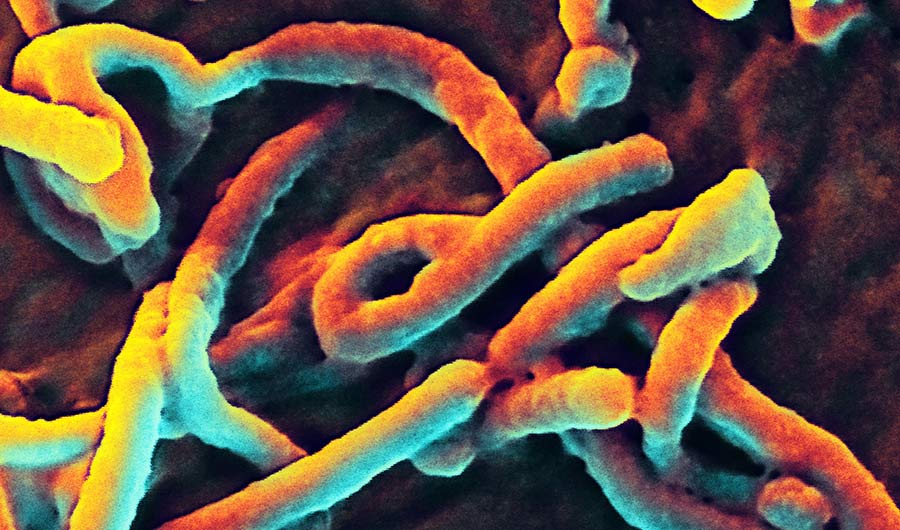 Micrograph of ebola virus. 