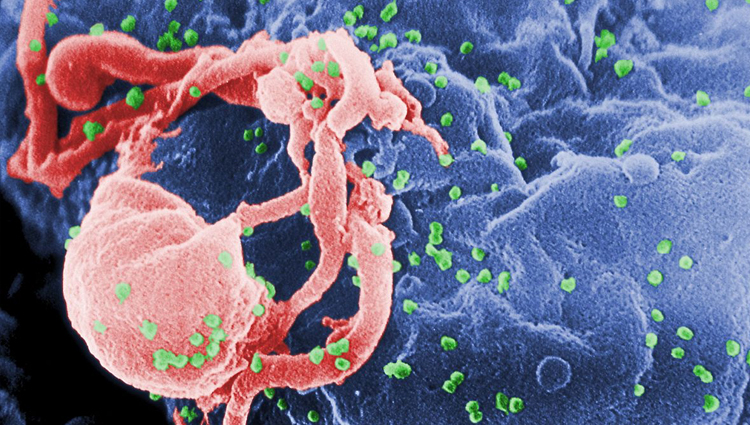 Micrograph of HIV.
