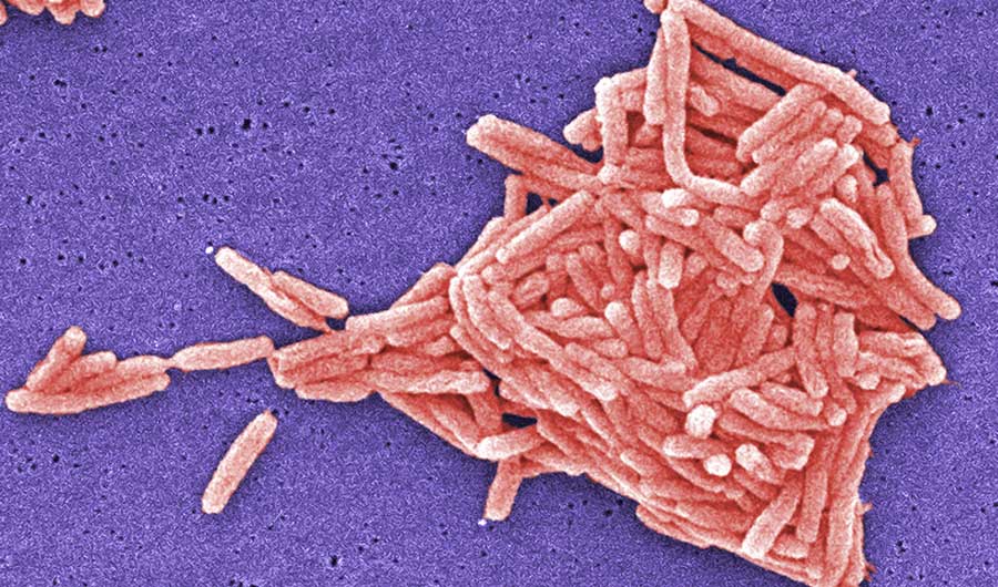Legionella bacteria micrograph. 