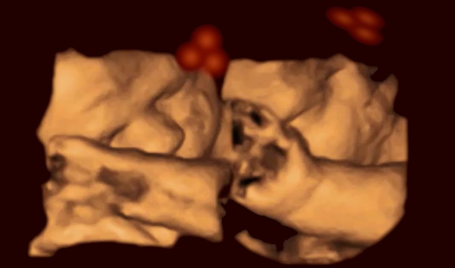 Ultrasound image of an infant in the womb. 