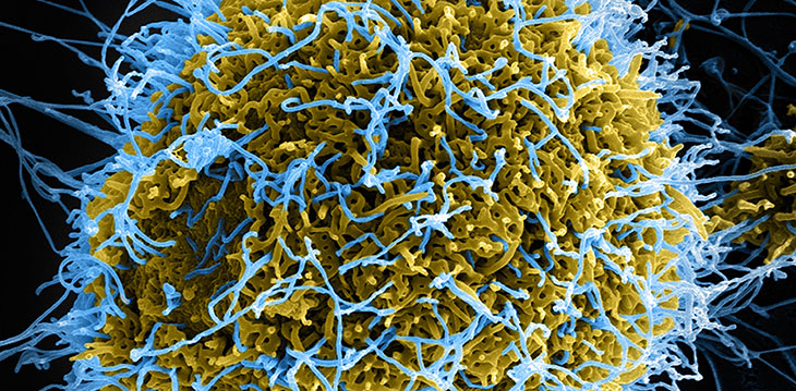 Micrograph of Ebola virus. 