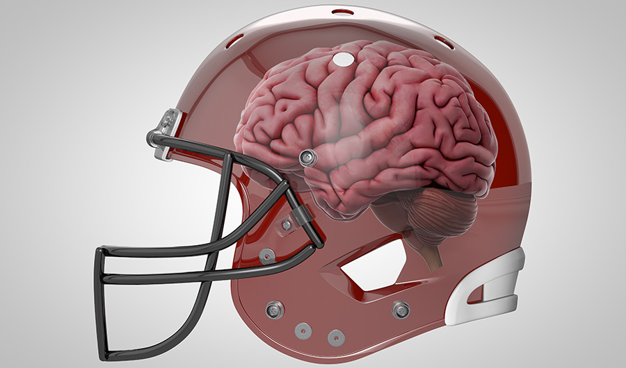 Whats The Risk Of Chronic Traumatic Encephalopathy For Nfl
